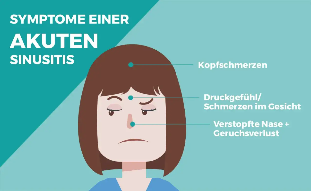 Kopfschmerzen, Druckgefühl im Gesicht, verstopfte Nase und Geruchsverlust sind typische nasennebenhöhlenentzündung symptome.