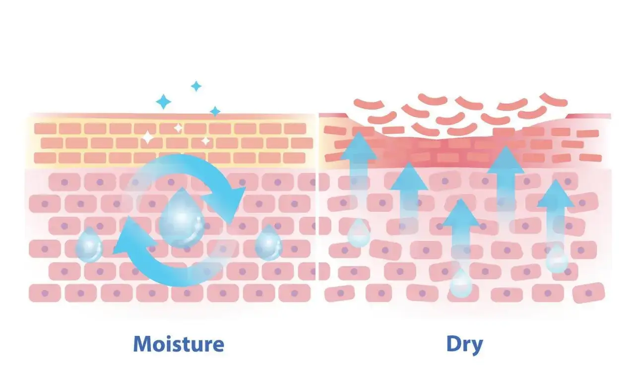 Healthy skin retains moisture, while dry skin shows increased transepidermal water loss with moisture escaping upwards.