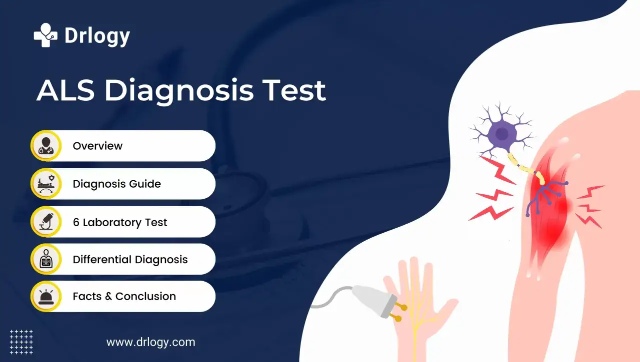 Drlogy: Test diagnostyczny ALS. Poznaj objawy, metody diagnozy i wyniki badań.