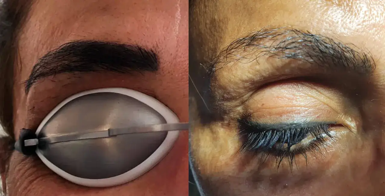 Permanent Make-up Entfernung Methoden Vergleich