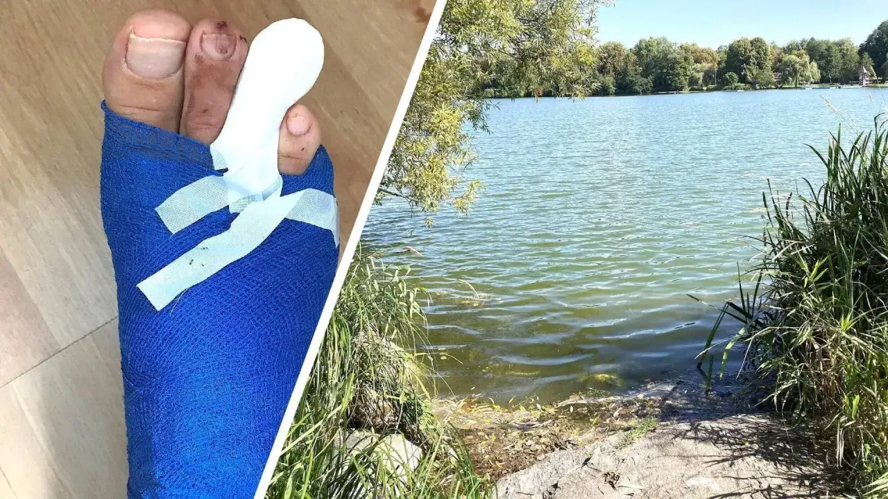 Verband am Zeh nach einem Hechtbiss im See.