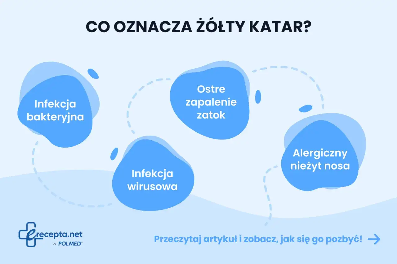 Żółty katar u dziecka może oznaczać infekcję bakteryjną, wirusową, ostre zapalenie zatok lub alergiczny nieżyt nosa. Dowiedz się więcej.
