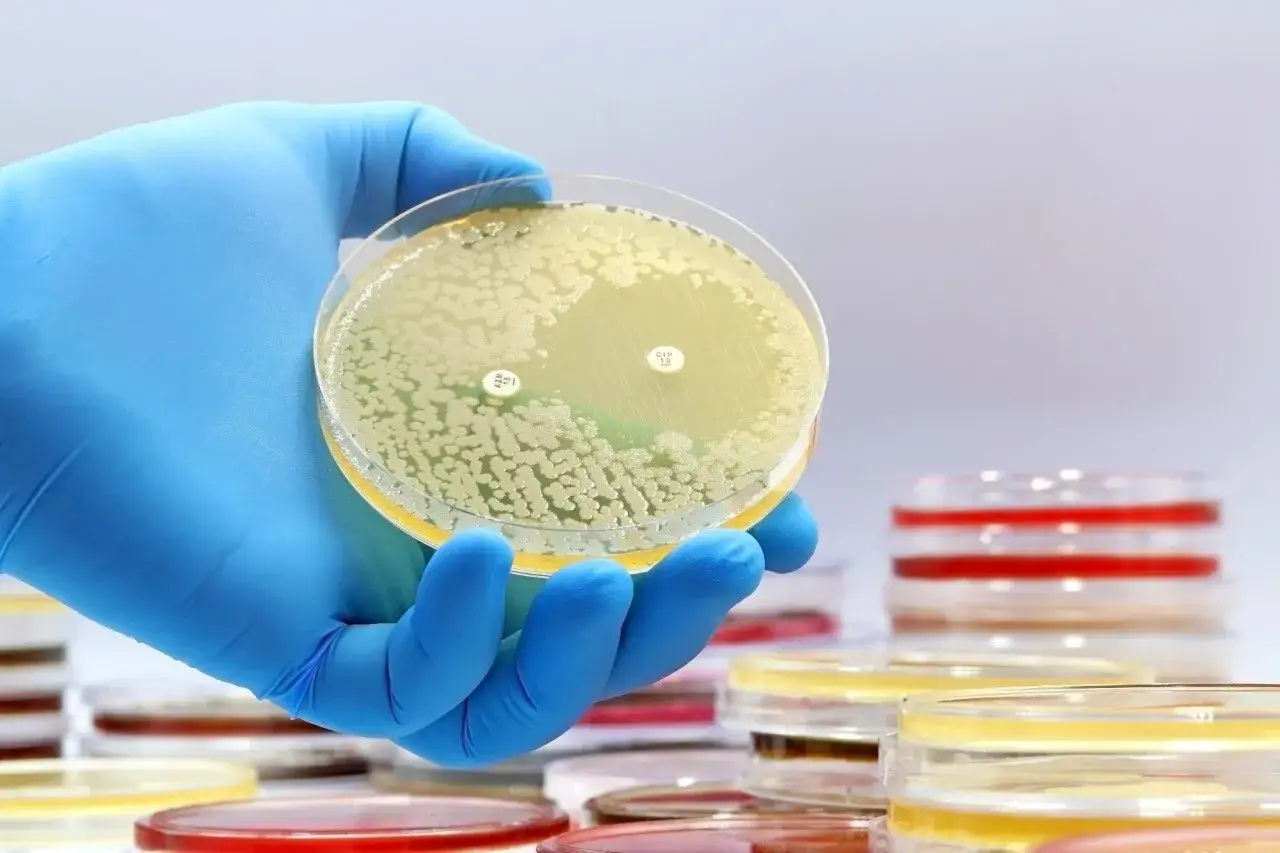 Piatto di Petri con coltura batterica e dischetti di antibiotici per studiare come eliminare pseudomonas aeruginosa.