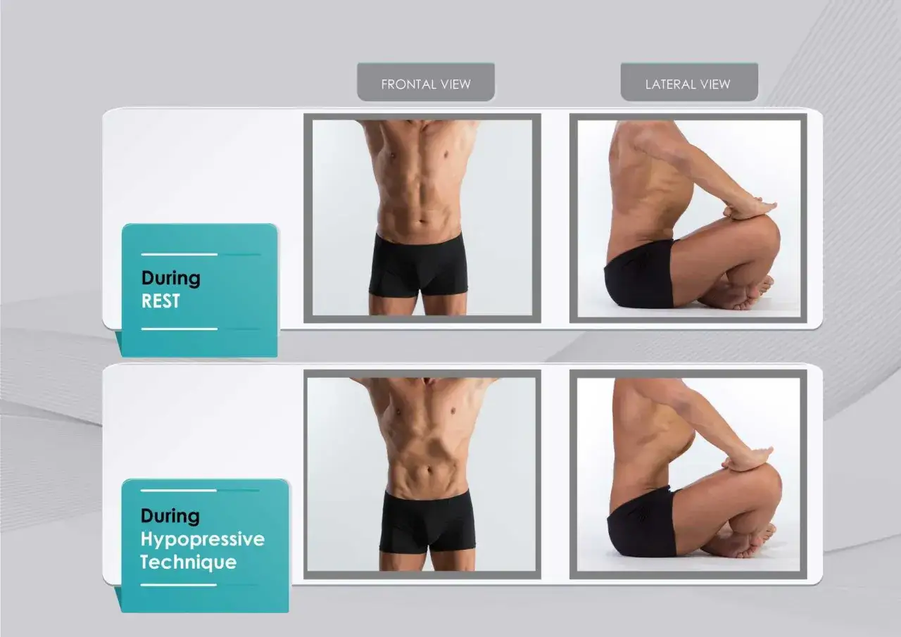 Comparaison des abdos : au repos, le ventre est d&eacute;tendu. Pendant la technique hypopressive, le ventre se creuse visiblement.