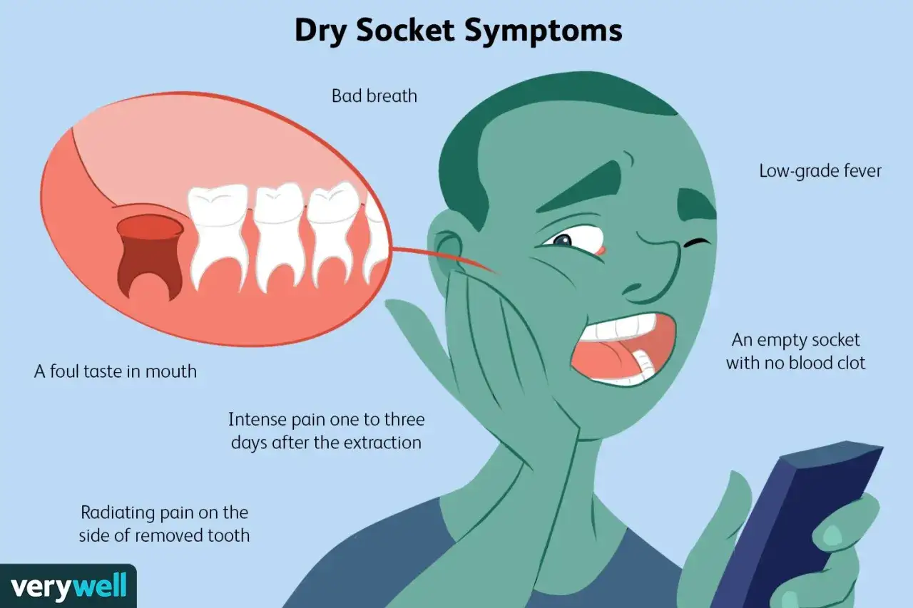 Hombre con dolor insoportable por alveolitis, mal aliento y sabor desagradable. Muestra un hueco vacío tras extracción dental.