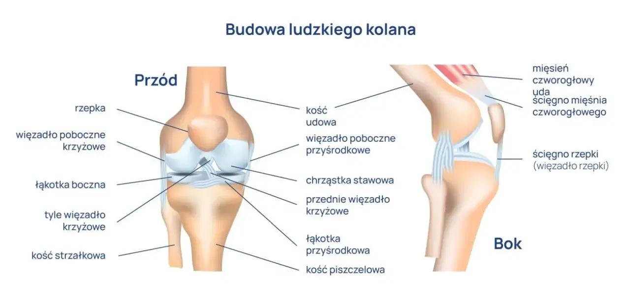 rodzaje bólu kolana infografika