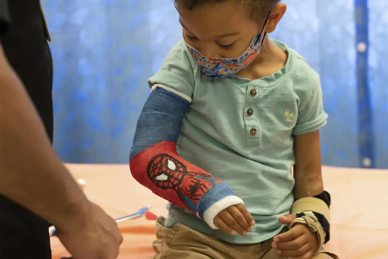 Junge mit Spiderman-Gips am gebrochenen Arm. Er trägt eine Maske und schaut auf seinen Arm.
