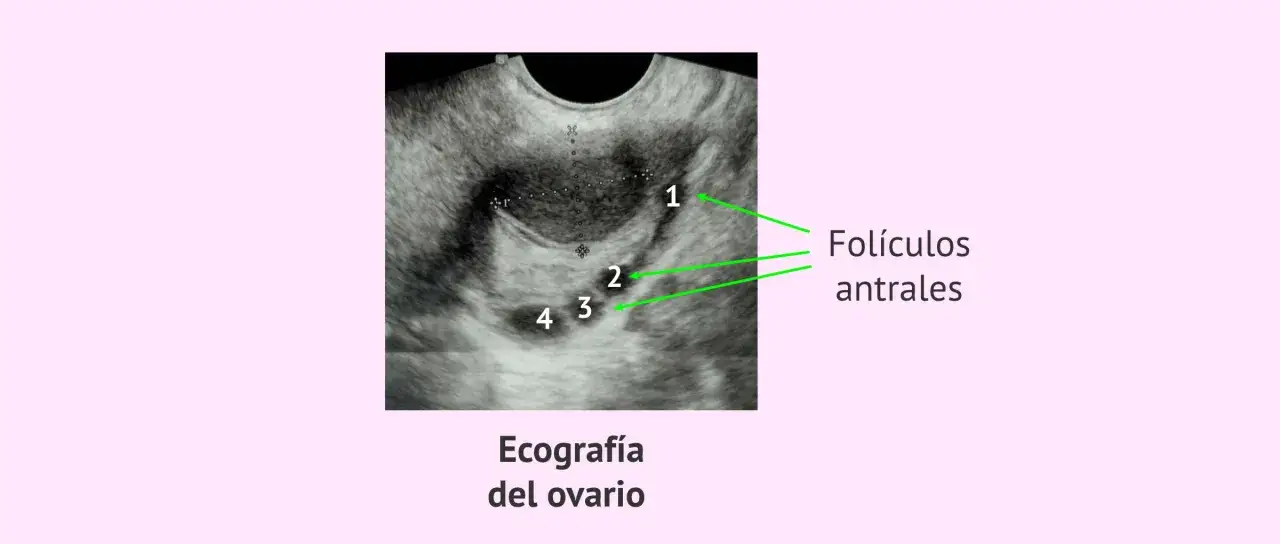Ecograf&iacute;a de ovario mostrando varios fol&iacute;culos antrales numerados 1, 2, 3 y 4.