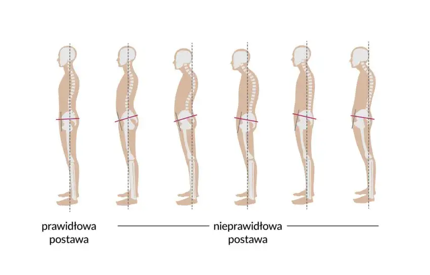 prawidłowa postawa ciała vs zgarbiona sylwetka