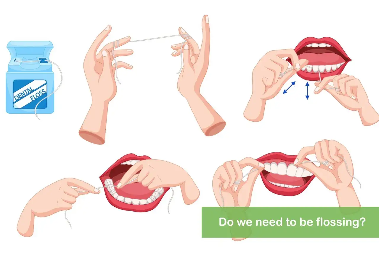 Illustrazione mostra come usare il filo interdentale per una corretta igiene orale.
