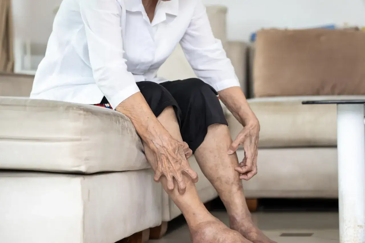 Gambe anziani con pelle secca e macchie, che indicano il passare del tempo e la necessità di cure.