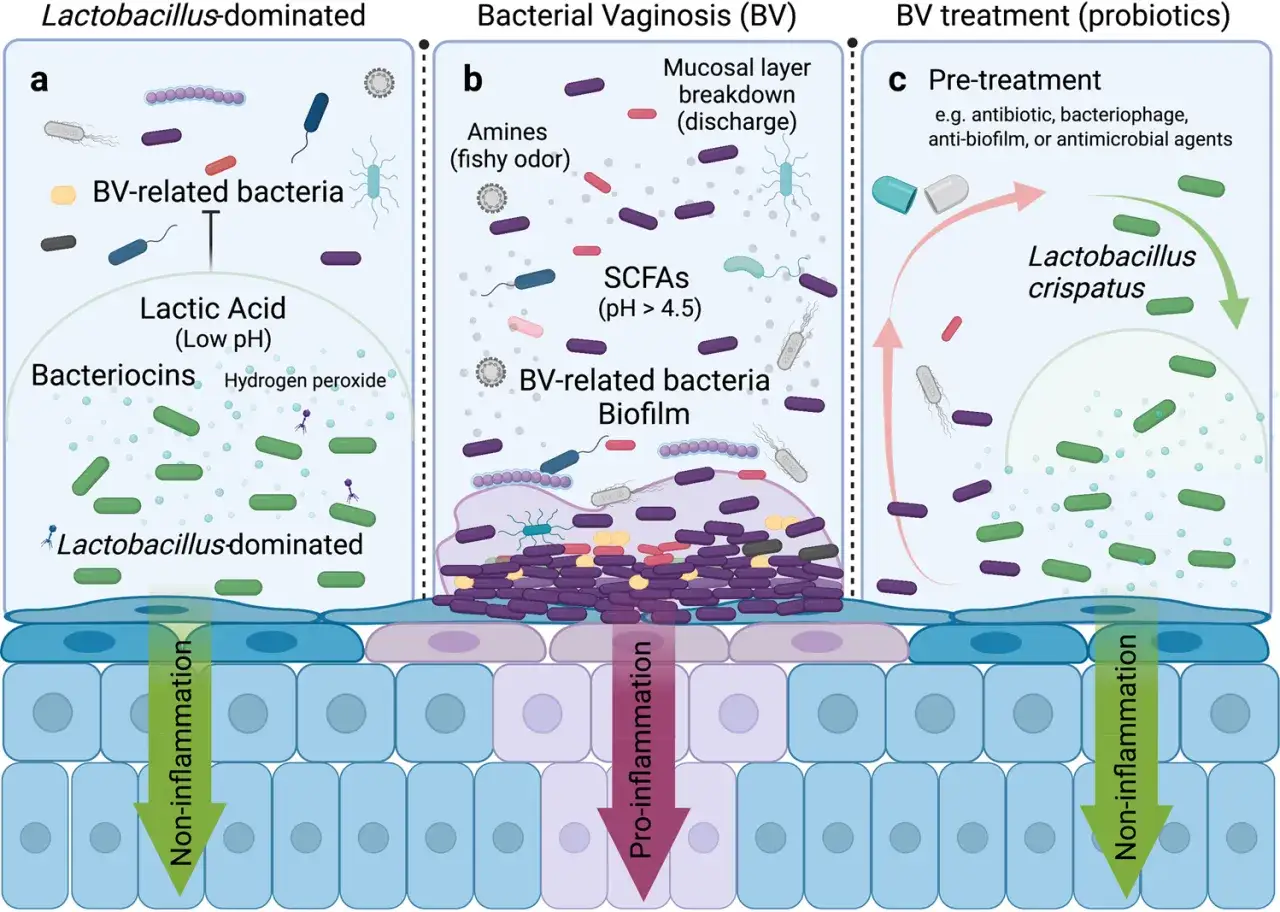 Ilustraci&oacute;n compara la flora vaginal sana (Lactobacillus) con la vaginosis bacteriana (BV), mostrando sus causas y tratamiento con probi&oacute;ticos.
