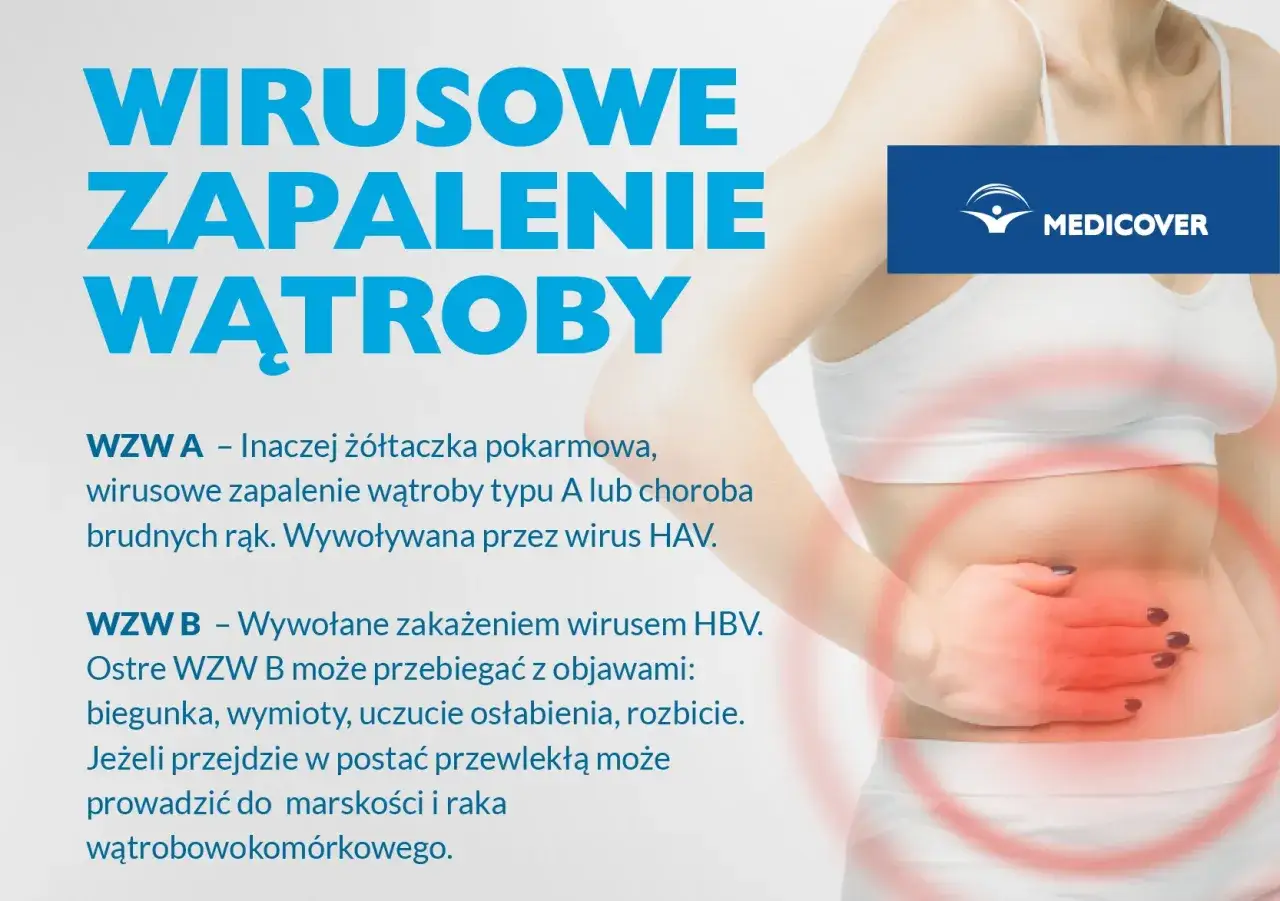 Wirusowe zapalenie wątroby (WZW) A, znane jako żółtaczka pokarmowa, to choroba brudnych rąk. WZW B wywołuje wirus HBV.