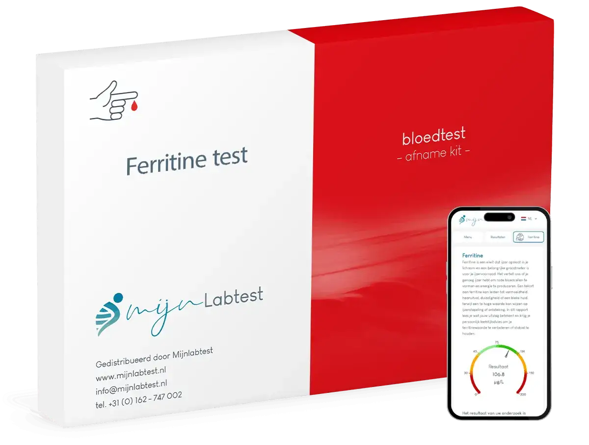 Ferritine test kit en smartphone met resultaten. Laag ferritine kan gevaarlijk zijn, wat leidt tot vermoeidheid en haaruitval.