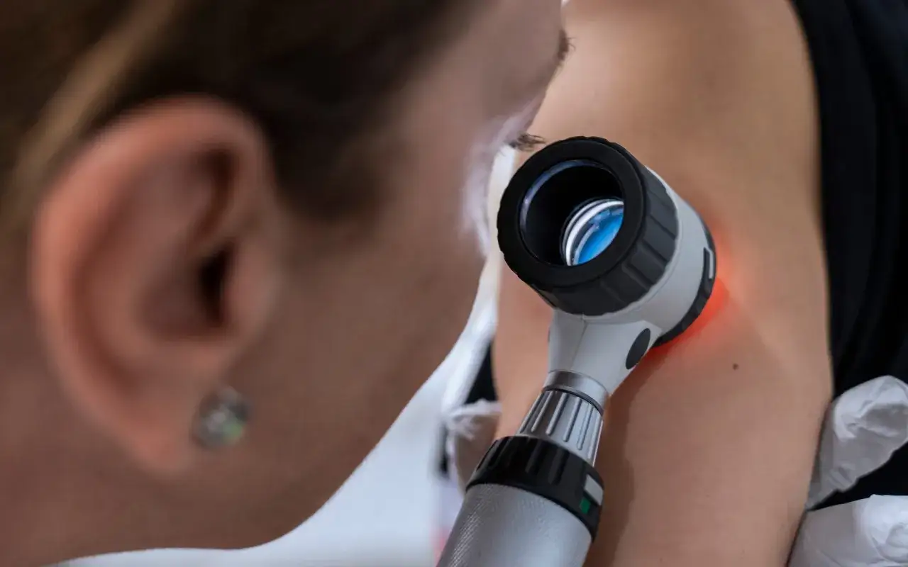 Dermatolog bada znamiona. Skierowanie do dermatologa jest ważne dla zdrowia skóry.