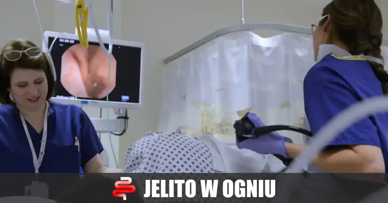 Przygotowanie do kolonoskopii w placówce
