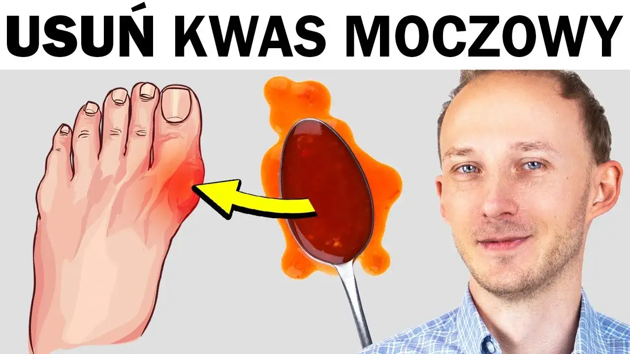 Domowe sposoby na ból dny moczanowej