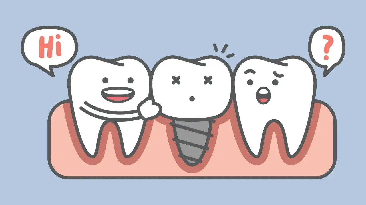 Denti animati: uno saluta, uno è un impianto dentale, l'altro è perplesso. Sembra che qualcuno sia senza denti a 40 anni.