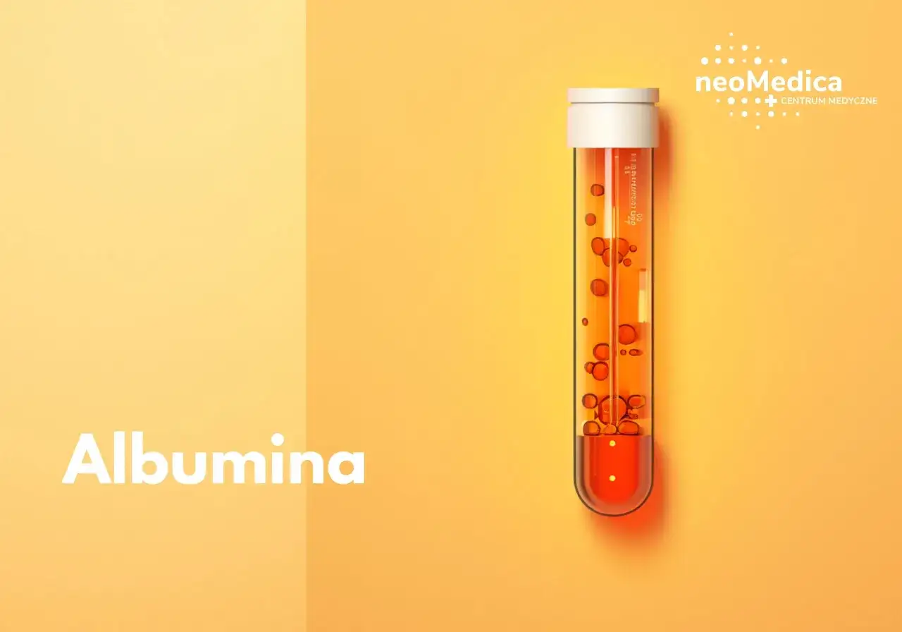 Próbówka z pomarańczowym płynem i pęcherzykami, symbolizująca badanie **albumina**. Obok napis 