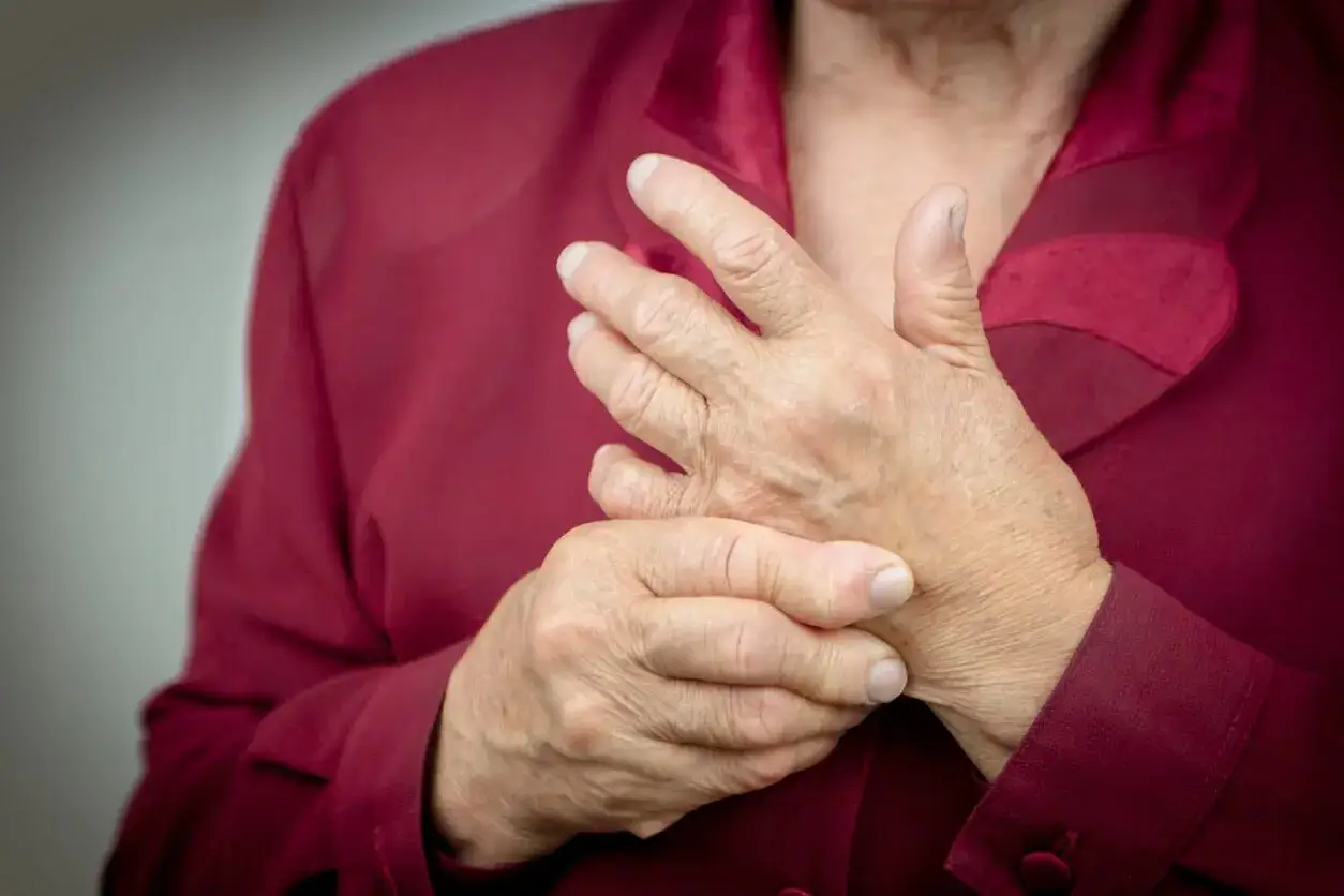 H&auml;nde einer &auml;lteren Person, die sich schmerzhaft an den Fingern greifen, ein Zeichen von chronischer Polyarthritis.