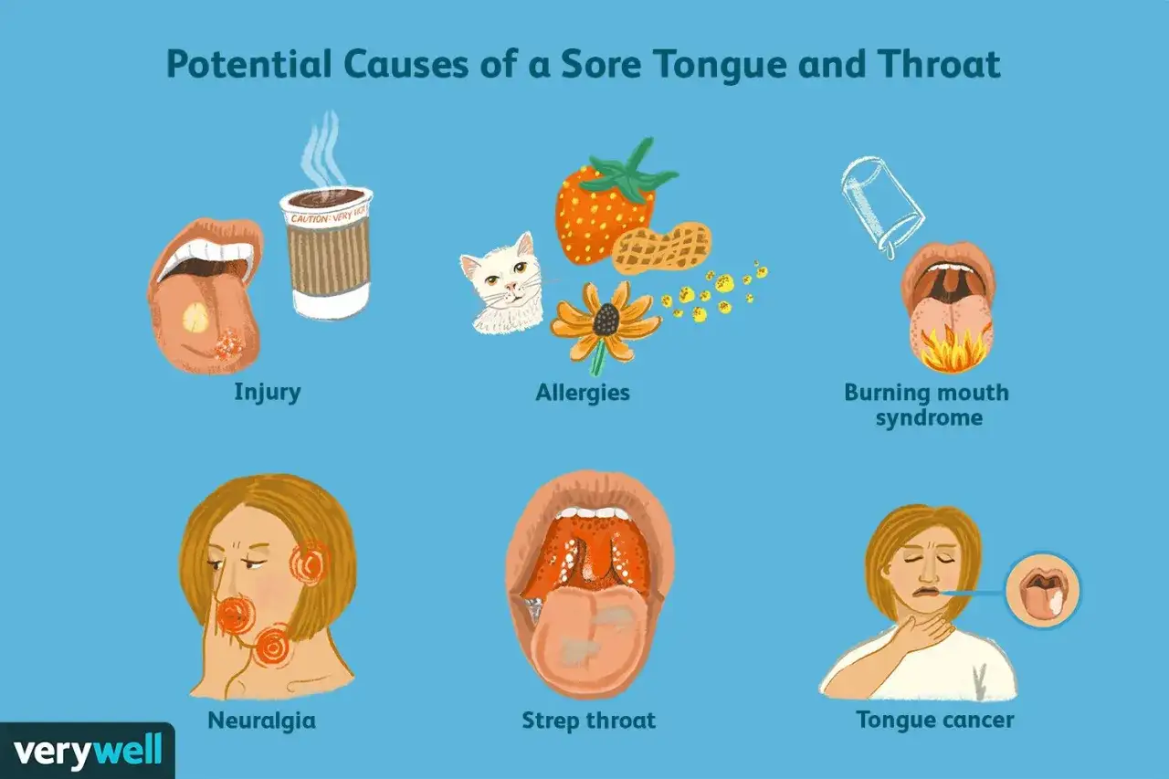 Illustrazione delle cause di mal di lingua e gola: lesioni, allergie, sindrome della bocca che brucia, nevralgia, mal di gola da streptococco e cancro alla lingua. La lingua strana ai lati pu&ograve; indicare vari problemi.