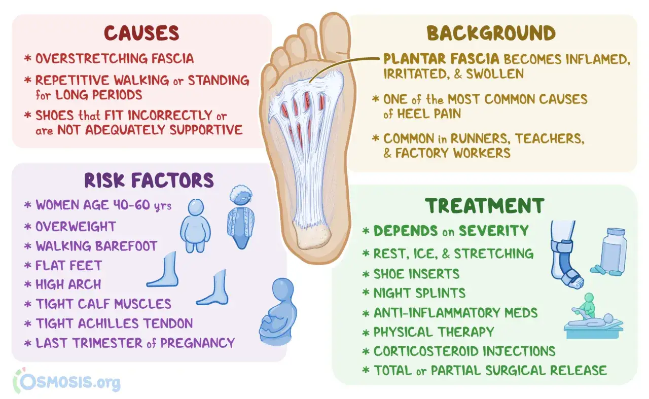 Was ist Plantarfasziitis? Entzündung der Plantarfaszie, Ursachen, Risikofaktoren und Behandlung von Fersenschmerzen.