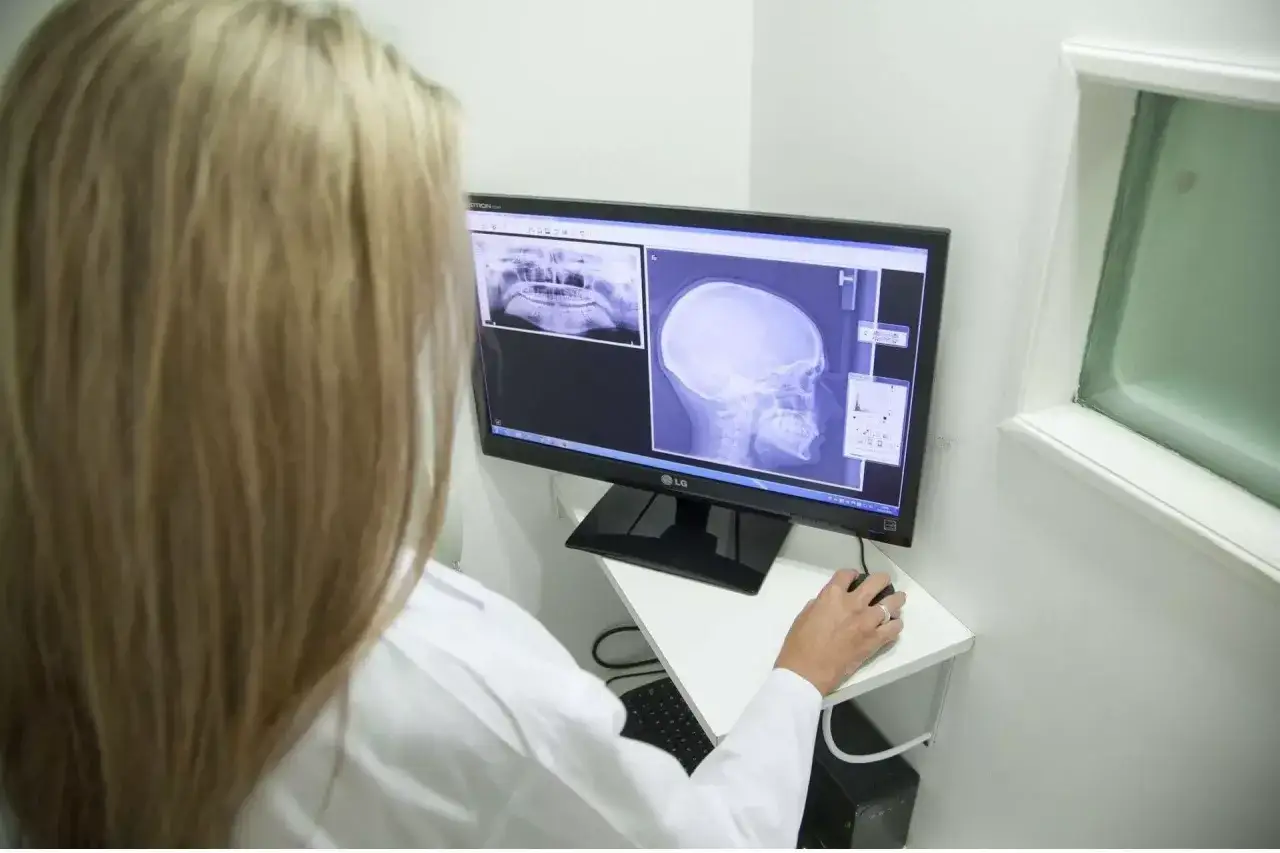 Lekarz analizuje zdjęcie cefalometryczne czaszki i zębów na monitorze.