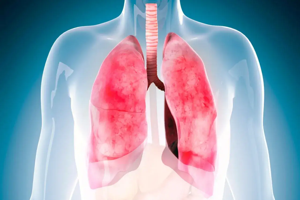 Nowoczesne terapie onkologiczne, immunoterapia, terapie celowane