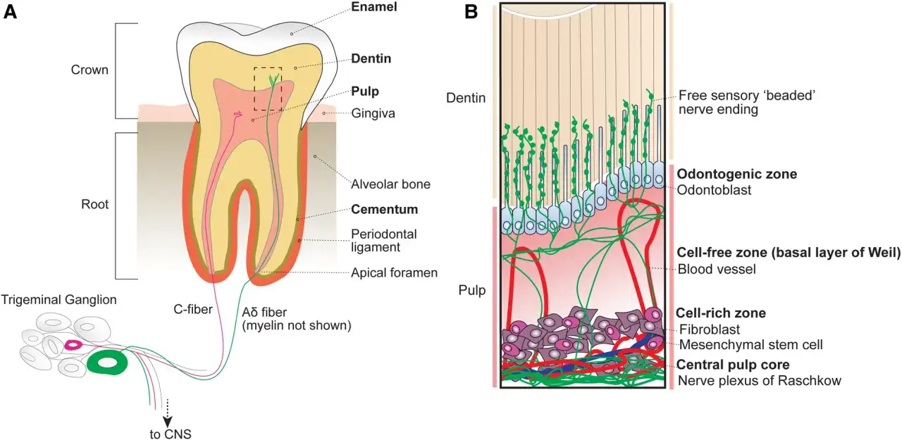 Sezione trasversale di un dente che illustra la polpa dentale e le fibre nervose. La pulpite dente è un'infiammazione dolorosa.