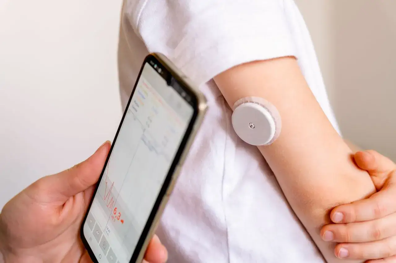 Moderne Technologie für das Diabetes-Management: Ein Sensor am Arm misst den Blutzucker, die Daten werden auf einem Smartphone angezeigt.