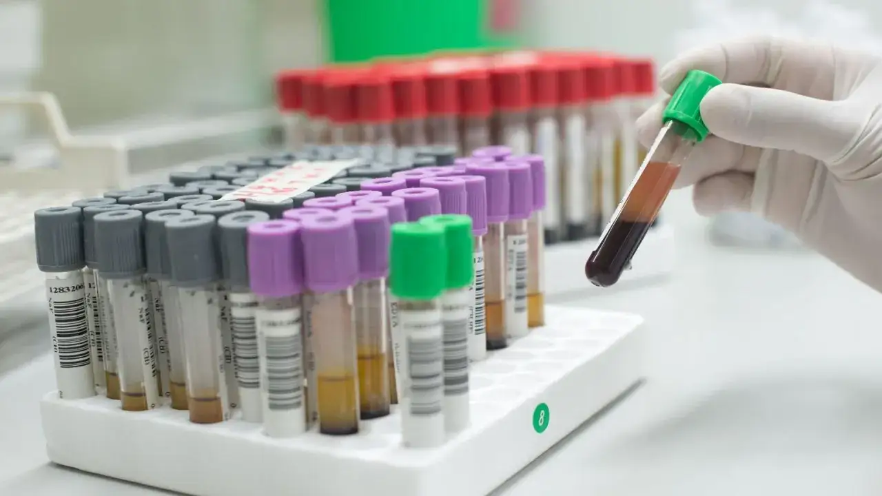 Rurki z próbkami krwi w laboratorium. Jedna z nich, trzymana w rękawiczce, pokazuje ciemną krew, sugerując, że monocyty za wysokie.