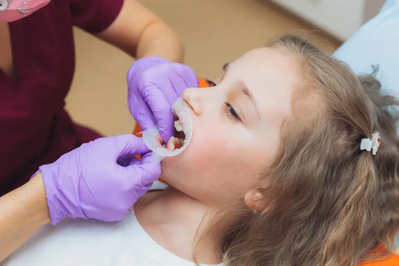 Dziecko u dentysty, przygotowanie do lakowania zębów. Sprawdź, jaka jest lakowanie zębów cena i zadbaj o uśmiech swojej pociechy.