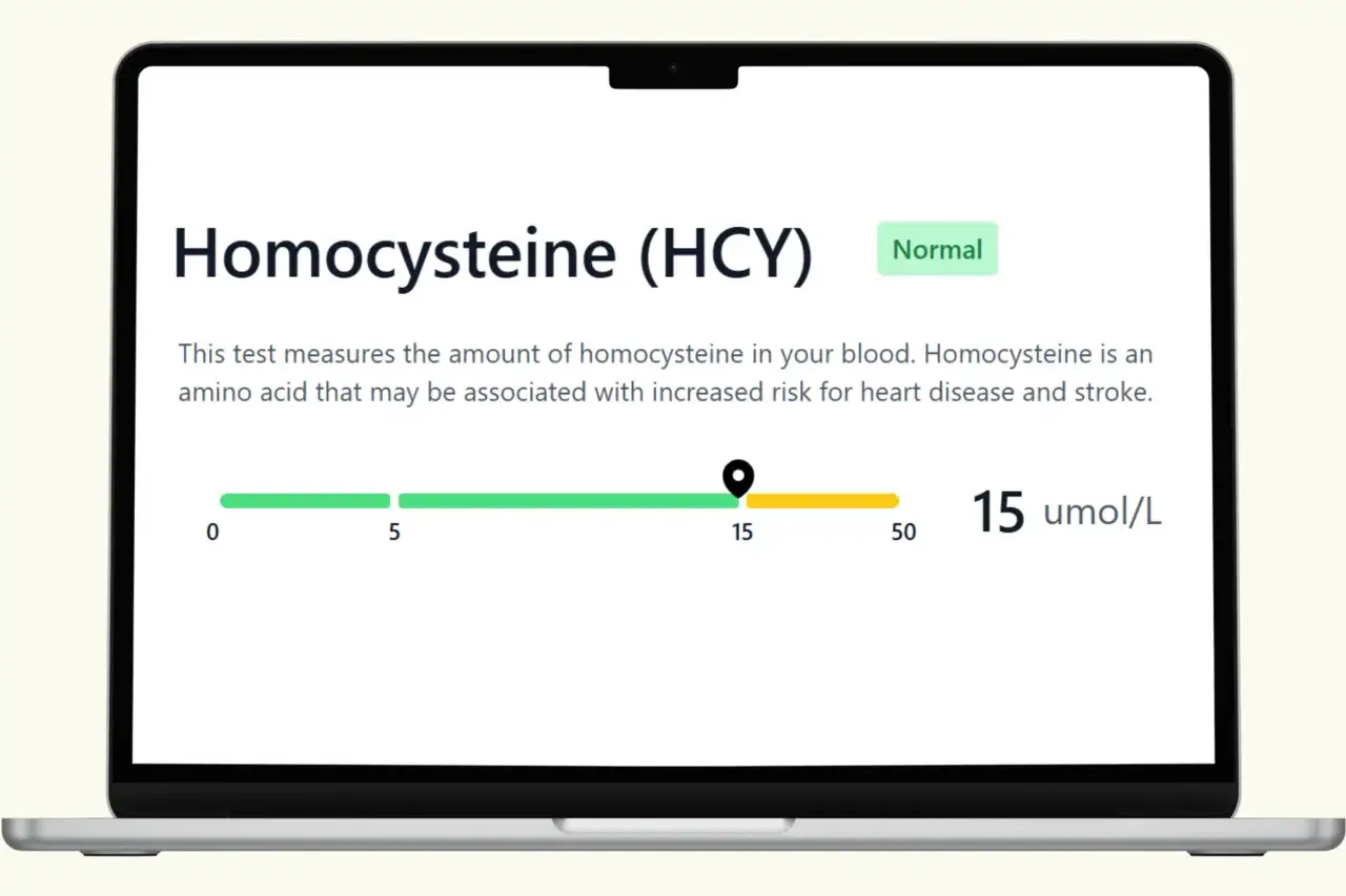 Wynik badania homocysteiny (HCY) wynosi 15 umol/L, co mieści się w normie. Podwyższona homocysteina może zwiększać ryzyko chorób serca.