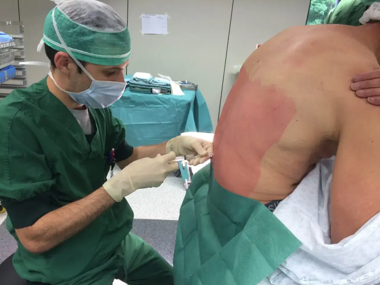 Un m&eacute;decin administre une anesth&eacute;sie p&eacute;ridurale &agrave; un patient. La zone du dos du patient est d&eacute;sinfect&eacute;e et pr&eacute;par&eacute;e pour l'injection.