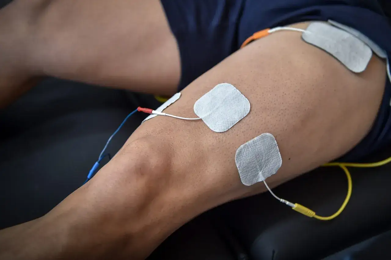 Elektroder fästa på ett lår för elbehandling av muskler.