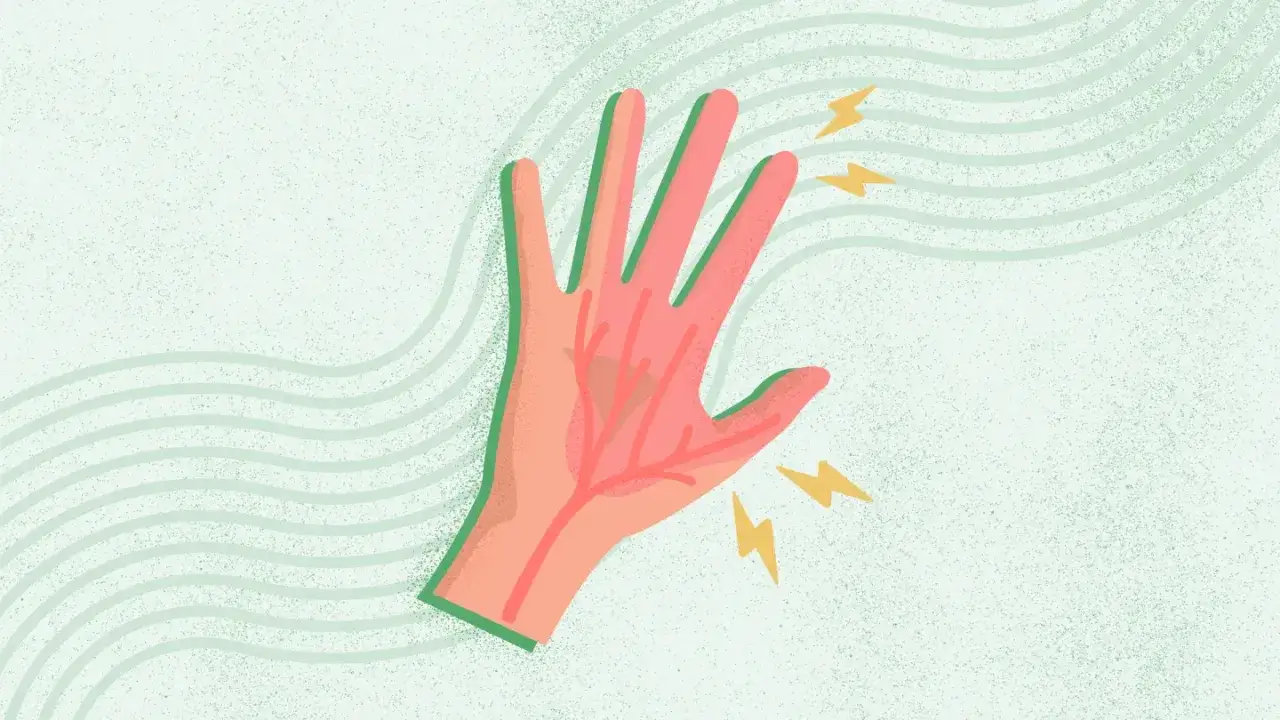Mano con segni di dolore e fulmini, che simboleggiano la neuropatia sensitiva.