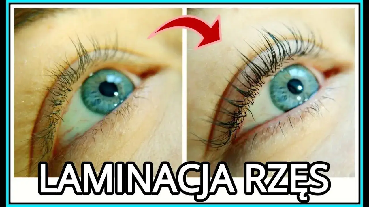 Zdjęcie Botox rzęs co to jest: poznaj efekty i różnice z laminacją
