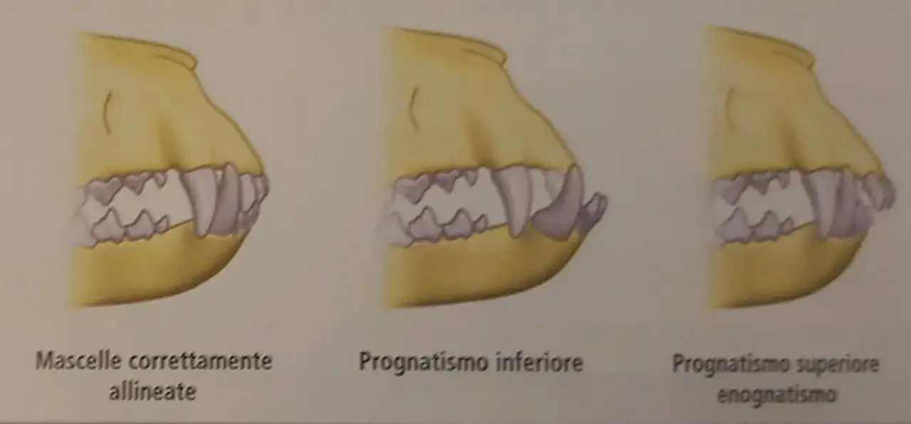 Illustrazione di tre mascelle canine: una con allineamento corretto, una con prognatismo inferiore e una con prognatismo superiore. Il dente canino è visibile in ogni caso.
