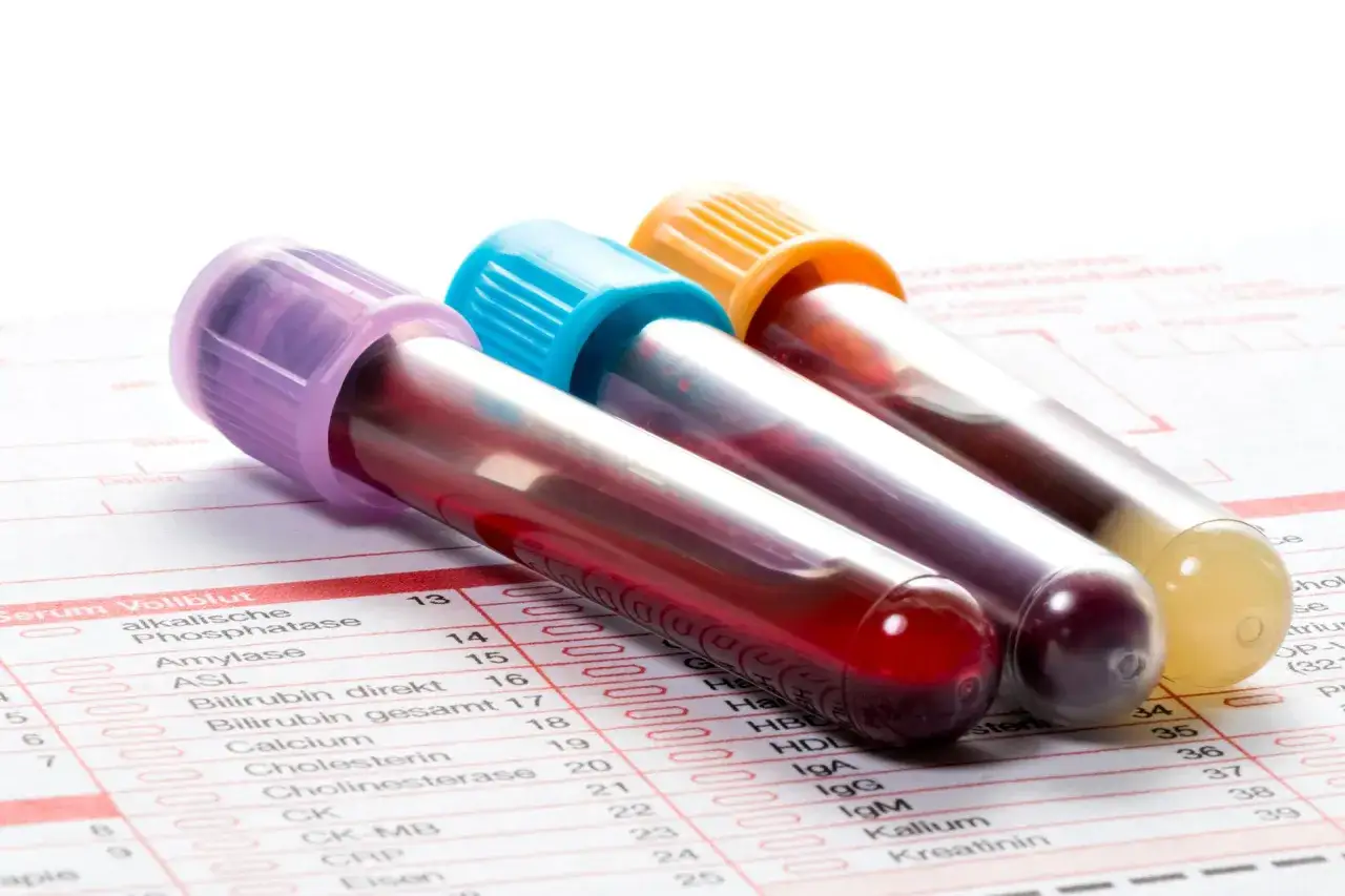 Probówki z krwią na tle formularza badań. Widać m.in. oznaczenie CRP, co to jest, jest kluczowe w diagnostyce stanu zapalnego.