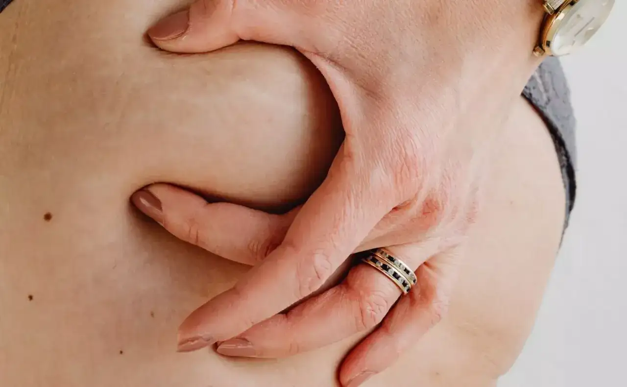 Dłoń dotyka skóry z widocznymi rozstępami czerwonymi, które są naturalnym śladem na ciele.