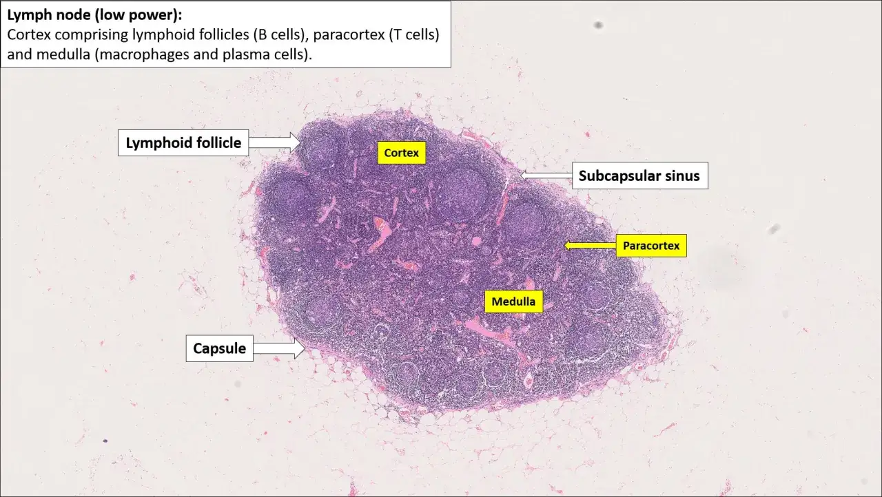 Histologie eines Lymphknotens: Kapsel, Rinde mit follikeln, Parakortex und Mark sind sichtbar.