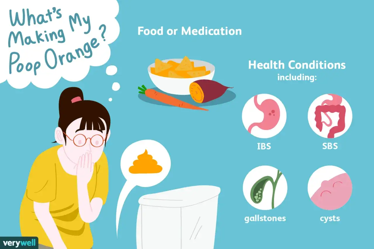 Una persona si preoccupa perch&eacute; i suoi feci arancioni potrebbero essere causati da cibo o condizioni mediche come IBS o calcoli biliari.