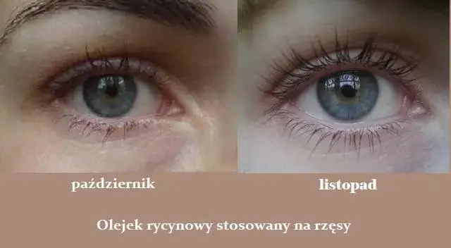 olejek rycynowy rzęsy przed i po
