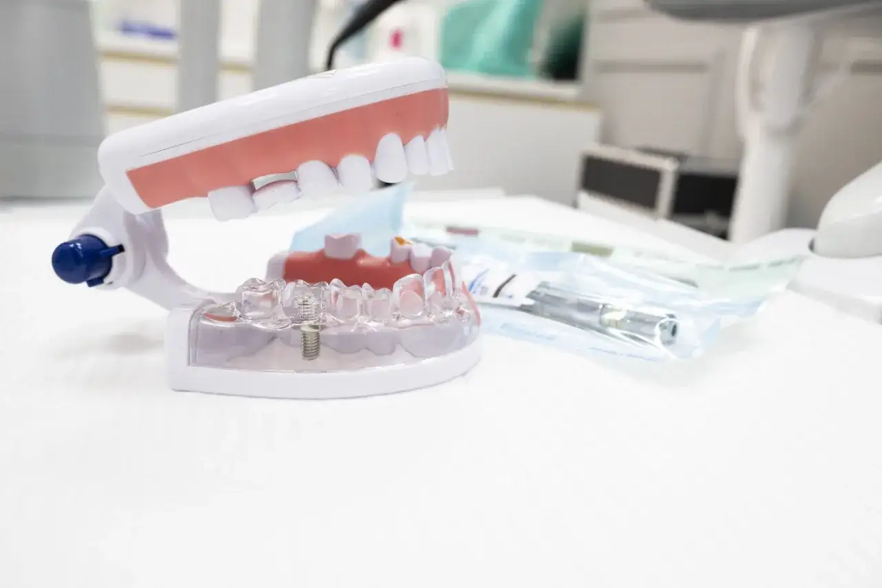 Model szczęki z implantem i narzędziami dentystycznymi. Widać tu model zęba, który wymagał założenia plomby, a obok opakowania z narzędziami.