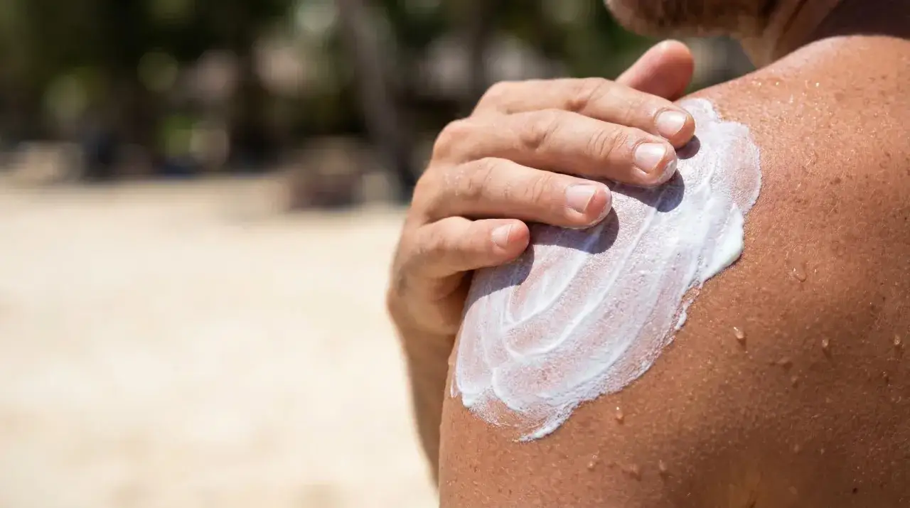 Main d'homme appliquant de la crème solaire sur son épaule. Attention, cette crème solaire est périmée, le soleil peut être dangereux.