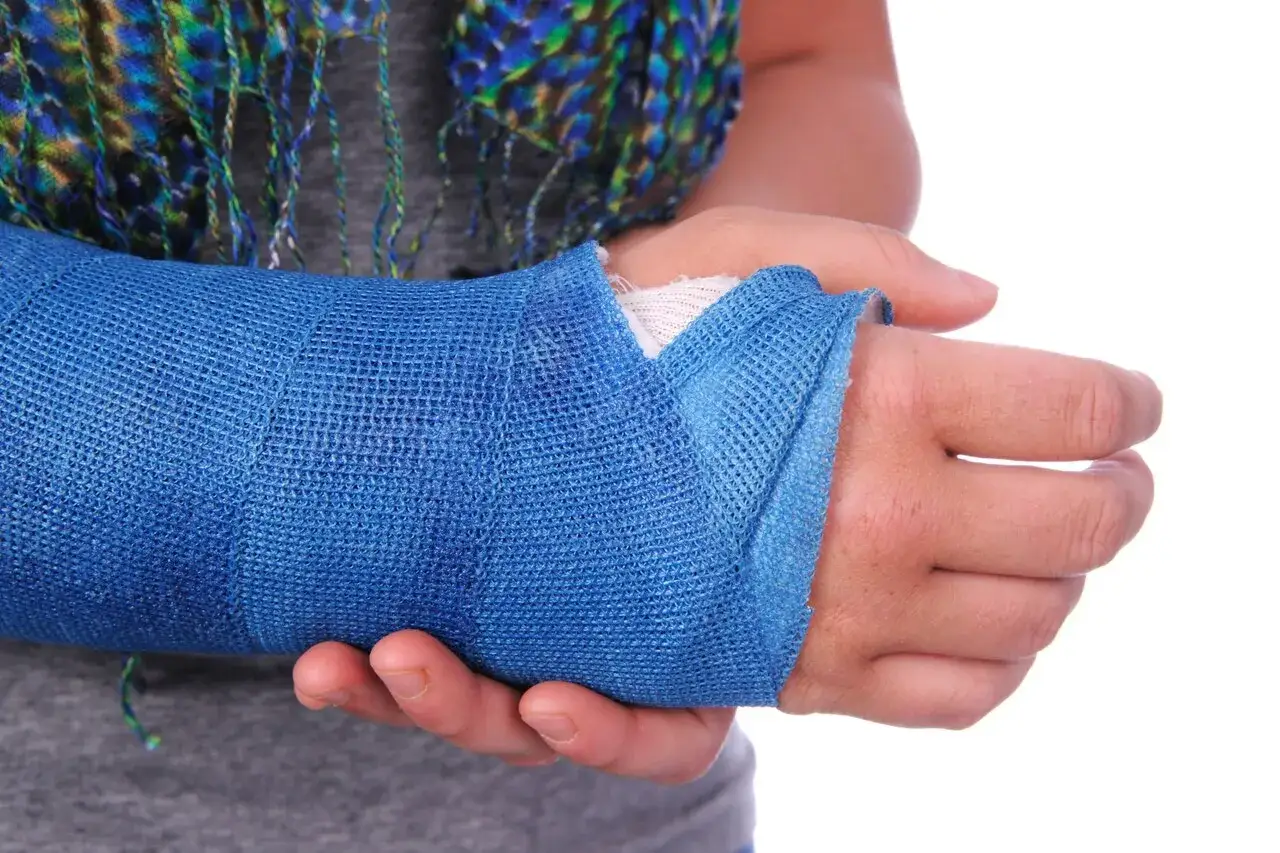 Nadgarstek w niebieskim opatrunku, przygotowany do rehabilitacji po urazie. Może być tam tytanowa płytka.
