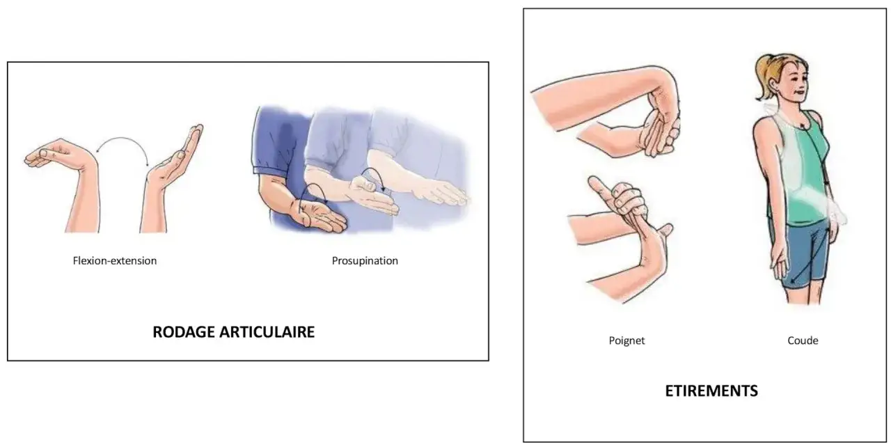 Exercices pour comment soigner une tendinite au coude : flexion-extension, supination, &eacute;tirements du poignet et du coude.