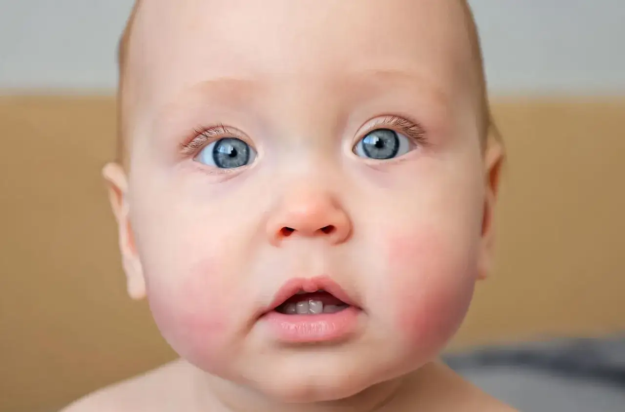 Neonato con guance rosse e i primi denti visibili, occhi azzurri spalancati.