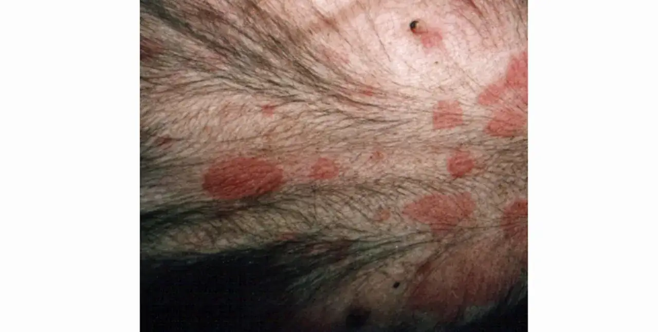 Peau de chien présentant des rougeurs et des irritations, symptômes possibles d'une allergie alimentaire.