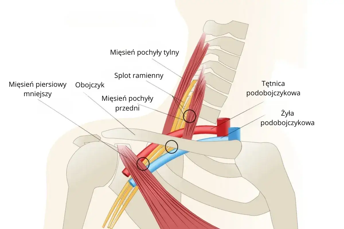 Anatomia g&oacute;rnego otworu klatki piersiowej: mięśnie pochyłe, splot ramienny, tętnica i żyła podobojczykowa, mięsień piersiowy mniejszy i obojczyk.